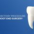 جراحی آپیکو دندان چیست؟